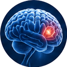 Pineal gland calcification icon
