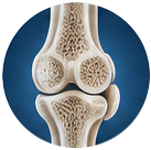 Skeletal fluorosis icon